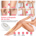 Depilador Laser IPL Hair Removal JDK-881-36W-Bivolt - Rosa